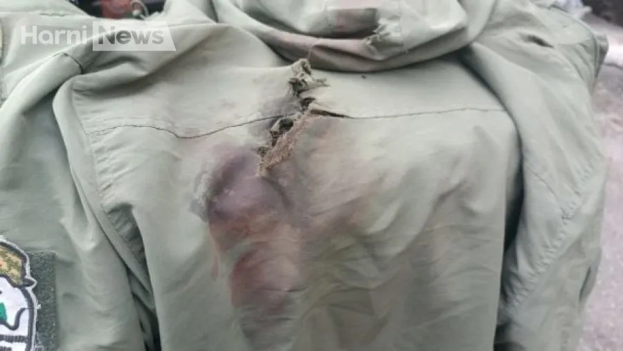 Газова гангрена повертається на фронт: як позиційна війна в Україні відроджує небезпечну інфекцію